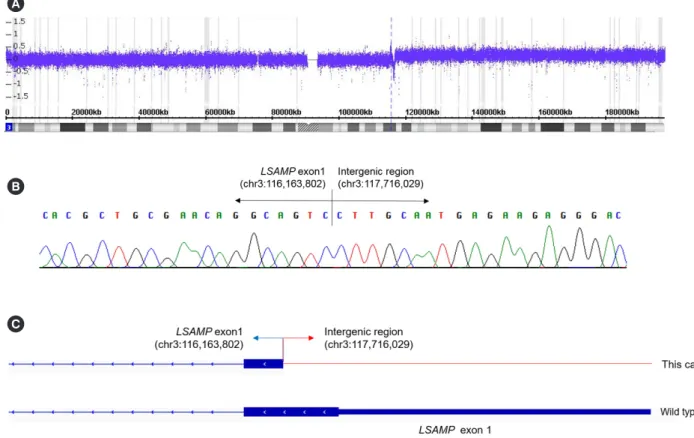 Fig. 2. The fusion transcript of the JT involving 3q13.3 identified by RNA-sequencing analysis and Sanger sequencing