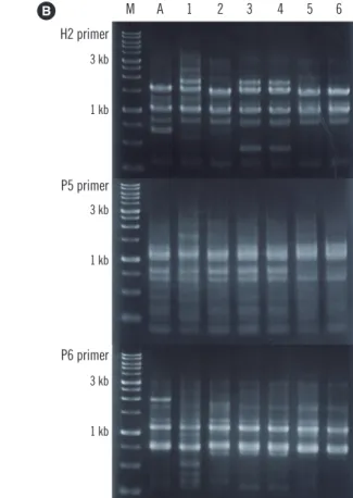 Fig. 1. Analyses of SDSE isolates causing repetitive infections: (A) PFGE and (B) RAPD DNA