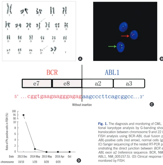 Fig. 1. The diagnosis and monitoring of CML. (A) Conven- Conven-tional karyotype analysis by G-banding showing typical  translocation between chromosome 9 and 22 (arrows)