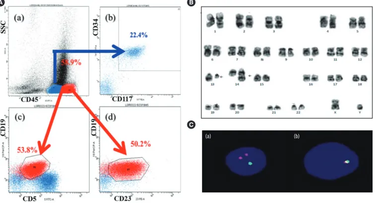 Fig. 2. Flow cytometric immunophenotyping and chromosomal analysis with bone marrow aspirate