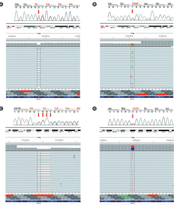 Fig. 1. Identification of deleterious mutations in BRCA1 or BRCA2 by Sanger sequencing and next-generation sequencing (NGS), as visual- visual-ized by Sequencher Software (top) and Integrative Genomics Viewer (IGV, bottom), respectively