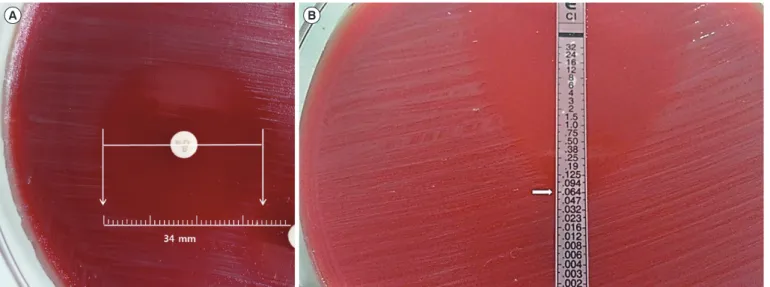 Table 1. Zone diameters of Neisseria meningitidis isolate