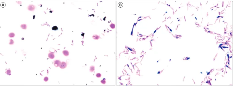 Fig. 1. Light microscope observation of Gram stain preparations. (A) Gram stain of aerobic blood cultures showed Gram-negative bacilli  (×1,000)