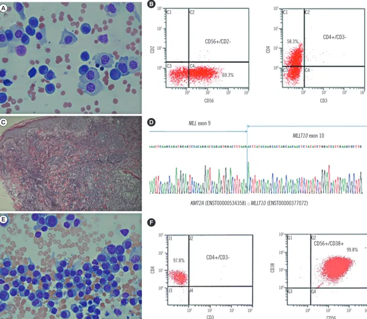 Fig. 1. Morphological features, flow cytometric analysis, immunohistochemical stain, and genetic study of the two cases of CD4+/CD56+ 