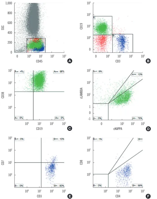 Fig. 2. Flow cytometry analysis  of circulating lymphocytes. (A)  and (B) CD45 and side scatter  (SSC) gating: T-cells were  posi-tive for CD3, and B-cells were  positive for CD19