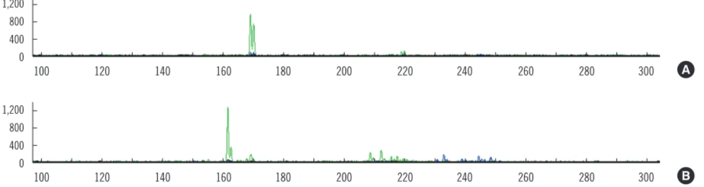 Fig. 2. T cell receptor gamma locus ( TRG) rearrangement analyzed by using BIOMED-2 multiplex PCR