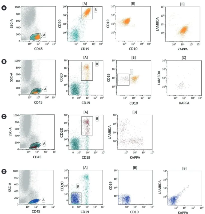 Fig. 1. Examples of  κ-to-λ ratios for patients with B-cell non-Hodgkin lymphoma using different gating strategies