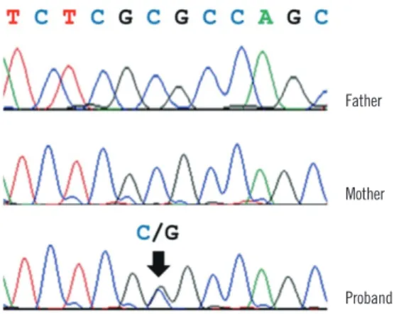 Fig. 2. Validation of a novel PAX3 variant by Sanger sequencing. 