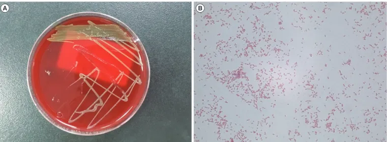 Fig. 1. Colony morphology and microscopic characteristics of Flavobacterium ceti. (A) Orange-colored, non-hemolytic colonies were ob- ob-served after two days of aerobic culture on a blood agar plate