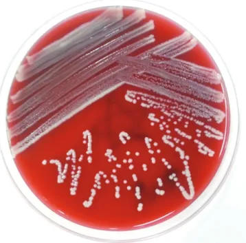 Fig. 1. Peripheral blood culture on blood agar showing pure iso- iso-lates as white, opaque, and smooth-edged colonies