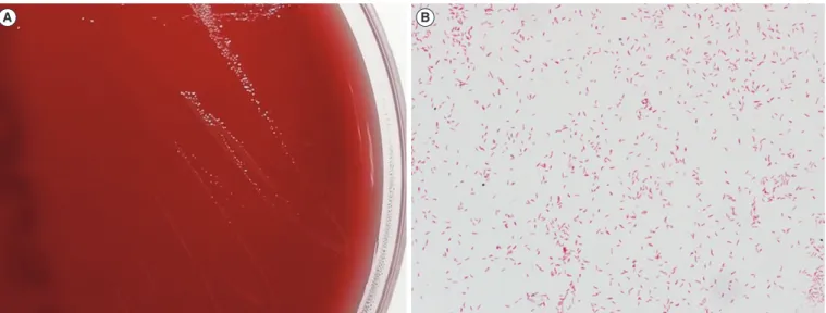 Fig. 1. Colony and microscopic characteristics of Campylobacter hyointestinalis. (A) Gray, flat, irregular and spreading colonies were ob- ob-served on a blood agar plate after 48 hr of microaerobic incubation