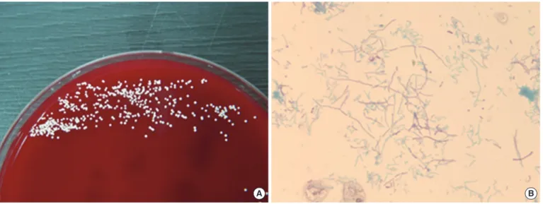 Fig. 2. Colony morphology on sub-inoculation and microscopic morphology. (A) Chalky-white colonies on blood agar plates at 36°C in 5% 
