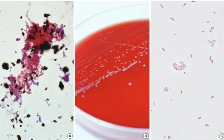 Fig. 1. Colonial and microscopic morphology of  Moraxella osloensis. (A) Gram-negative coccobacilli from positive aerobic blood culture  smear preparations (Gram stain, ×1,000)