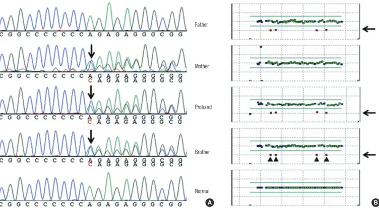 Fig. 2. (A) Sequencing analysis revealed a frameshift mutation (c.1893dup; p.Arg632Glnfs*20) in the proband, his mother, and his broth- broth-er
