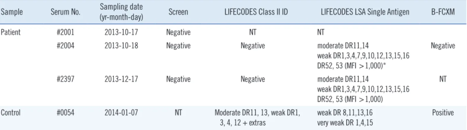 Table 1. HLA Class II PRA and B-flow cytometric crossmatch results for patient (#2001, #2004, and #2397) and control (#0054) sera Sample Serum No