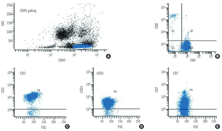 Fig. 2. Immunophenotyping of neoplastic lymphoid cells in peripheral blood by flow cytometry