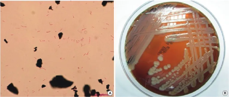 Fig. 1. (A) Gram-negative bacilli from smear preparations of the positive blood cultures (Gram stain,  ×1,000)