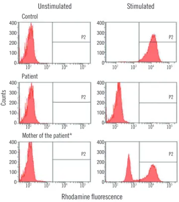Fig. 2. CYBB gene mutation analysis. A novel mutation (c.1078_1080delGACinsAA in exon 9) results in a frameshift in gp91 phox  (p.Asp 360Asnfs*26)