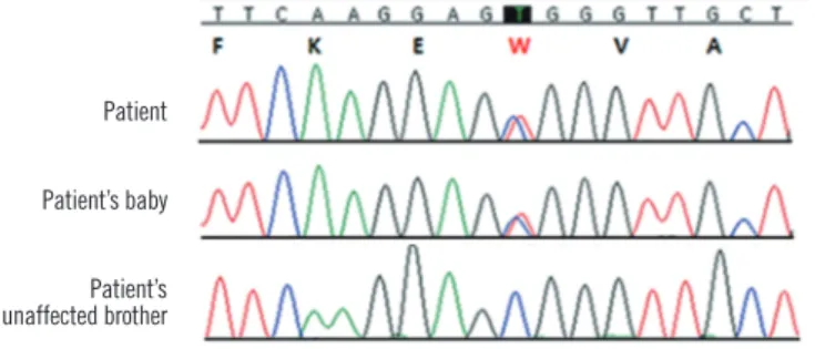 Fig. 2. DNA sequence analysis of the SPTA1 gene. The patient and  her baby carried a heterozygous missense mutation in exon 2  (c.121C>T; p.Arg41Trp) in the alpha 1 domain