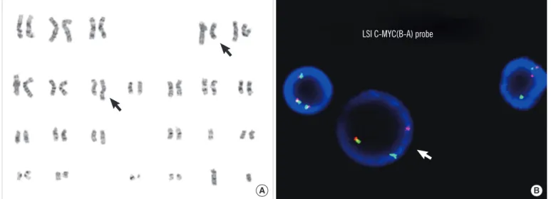 Fig. 2. Cytogenetic analysis showing complex chromosomal abnormalities including t(4;8)( q31.1;q24.1)