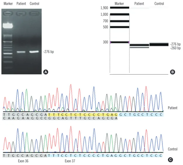Fig. 4. Results of agarose gel electrophoresis of RT-PCR products (A), capillary electrophoresis of RT-PCR products (B), and sequence  analysis (C) for the novel potential splice-site mutation c.3627-1G&gt;A