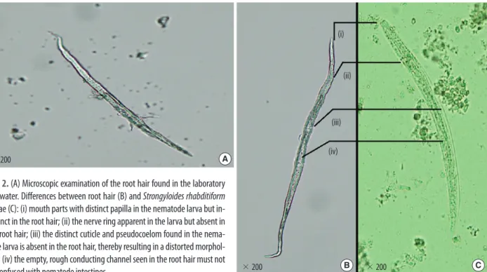 Fig. 2. (A) Microscopic examination of the root hair found in the laboratory  tap water