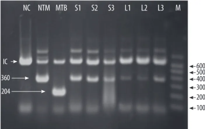 Fig. 1. Colony morphology on solid medium (A) and cord formation by acid- acid-fast bacillus (B) (Ziehl-Neelsen stain, ×1,000)