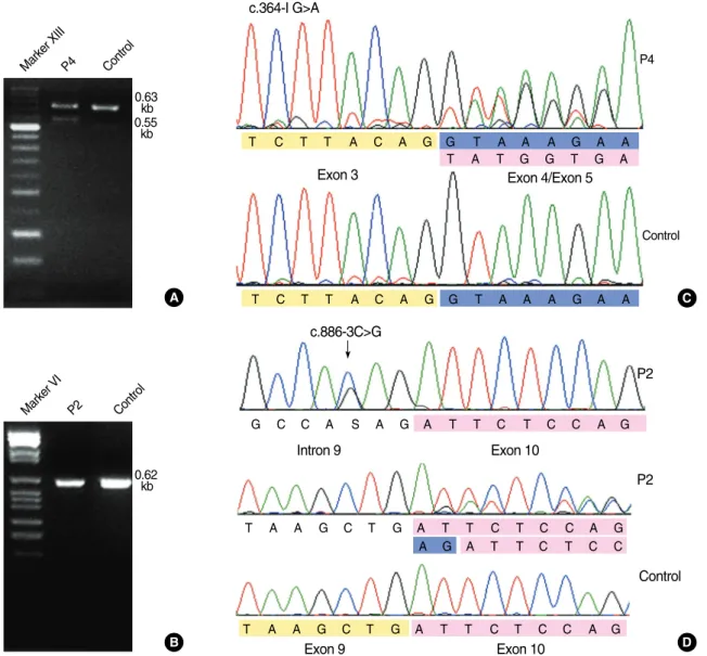 Fig. 1. Results of RT-PCR and sequence analysis for the 2 splice-site mutations c.364-1G>A (patient P4) and c.886-3C>G (patient P2).