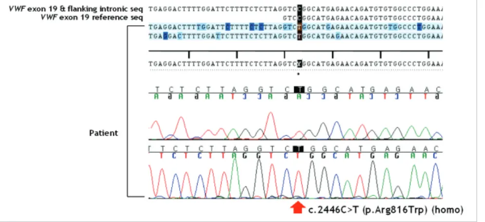 Fig. 1. VWF gene mutation analysis by direct sequencing revealed that the patient was homozygous for a missense mutation, c.2446C>T (p.