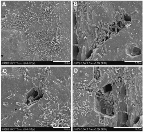 Fig. 5. SEM images of indigenous acidophilic bacteria attached to pyrite surface. After 8 days(pH=3.46) of bioleaching with supplement yeast extract(0.02%) at 42 o C