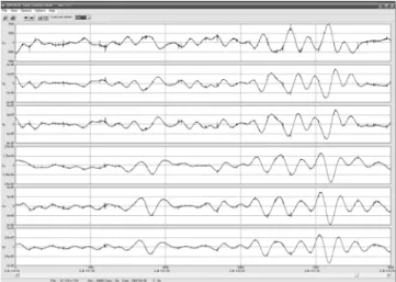 Fig. 3.  An example of time series of electric and magnetic fields observed at a field site (VC-231) and the remote site (RR-SWAN).