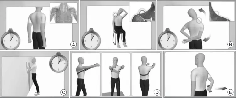 Figure 5. Parascapular exercise. (A) Postural correction exercise: scapula-pull exercise