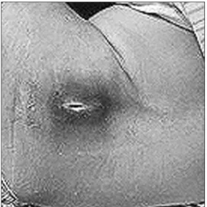 Figure 2. A Radiograph taken in 2009  showed minimal degenerative changes. 