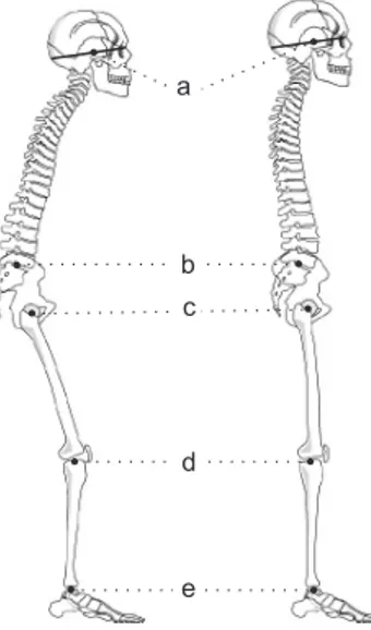 Figure 3. Schematic drawing depicting the 5 landmarks used in the  novel parameters for an assessment of the total body sagittal alignment