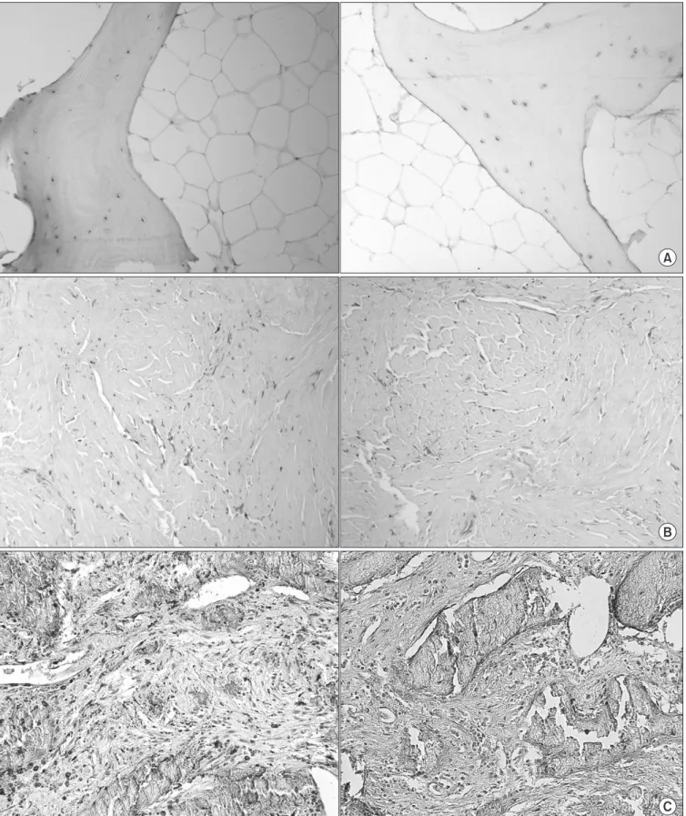 Figure 1. Representative microscopic images of CD74 and macrophage migration inhibitory factor (MIF) by immunohistochemistry (×200)