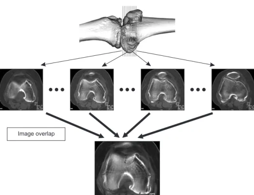 Figure 1. Reference points for each axis  for all axial cuts obtained by computed  tomography imaging were overlapped  as one comprehensive image using a  computer imaging program.