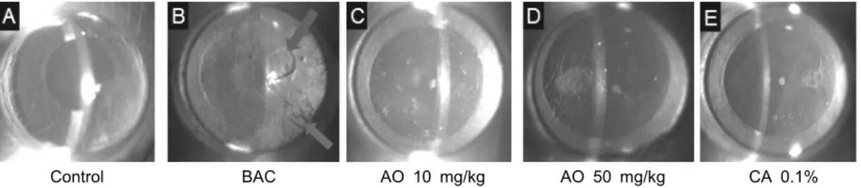 Fig. 1. Microscopic view of the cornea. Epithelial defect (upper arrow) and corneal neovascularization (lower arrow) is observed  in the benzalkonium chloride group (B)