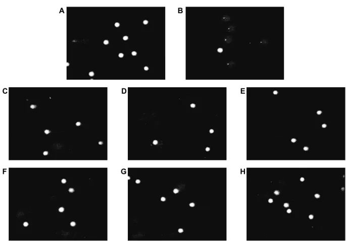Fig. 3. Micrographs representing images obtained from the comet assay. A: DMSO-treated normal control, B: 200 μM H 2 O 2 -treated  positive control, C: Fresh GIB+200 μM H 2 O 2 , D: Fresh YIB+200 μM H 2 O 2 , E: Fresh PIB+200 μM H 2 O 2 , F: Steamed IB+200