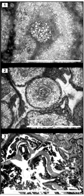 Fig. 10. Anatomical features of Cyathocaulis sp. (KPE P004). 