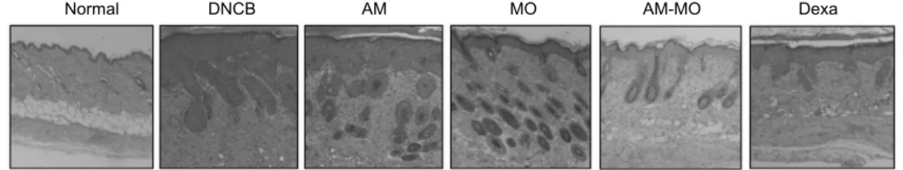 Table 2. Thickness of dorsal skins in the experimental groups Groups 1) Dosal skin thickness (mm) Normal DNCB AM MO AM-MO Dexa 0.60±0.03 a2)1.56±0.04d1.50±0.07cd1.38±0.09cd1.28±0.05c0.96±0.10b