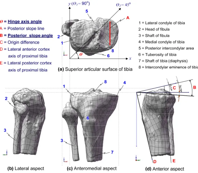 Fig. 1 Terminologies of proximal tibia using CT scan reconstruction (superior, anteromedial and lateral aspects)