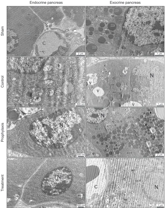 Fig. 4. Ultrastructural micro- micro-gra phs of experimental acute  pan crea titis. N: nucleus, mt: 