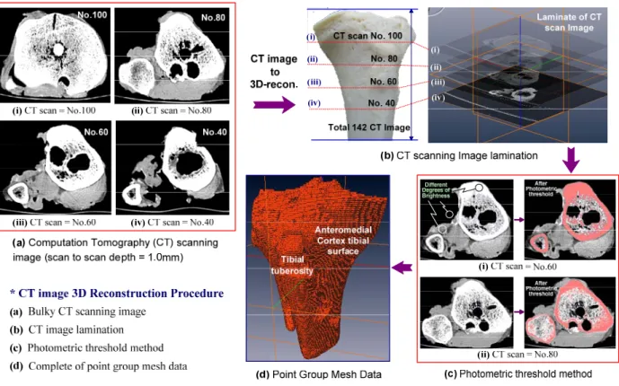 Fig. 1 Computer aided virtual surgery of opening wedge high tibia osteotomy using CT scan images reconstruction  reliable method to fix the planned correction 