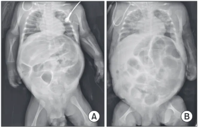 Fig. 1. (A) At 10 days postoperation, gradual aggravation and  distension of the abdominal cavity became pronounced due to  lack of stool passage