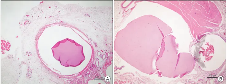 Fig. 3. (A, B) Measurement of luminal area at 8 weeks postoperatively (H&amp;E ×40). Measured patent luminal area was larger in  the treatment group than in the control group.
