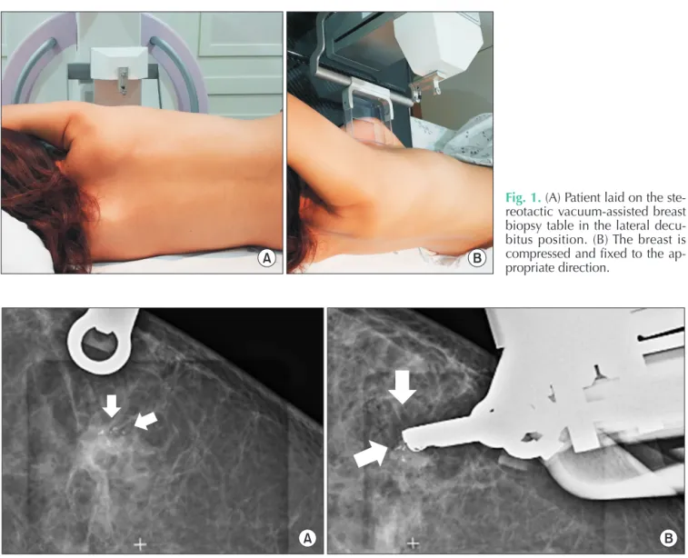 Fig. 1. (A) Patient laid on the ste­