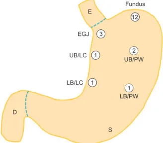 Fig. 5. Distribution of submucosal tumors in various portions  of the stomach. The number in each circle indicates the  frequency