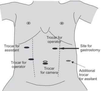 Table 1. Operative techniques