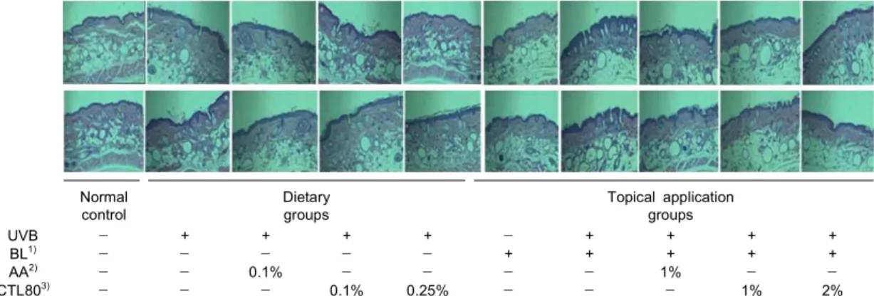 Fig. 2. Histological observation on UVB-induced hairless mice skin after 10 weeks experiment to evaluate the inhibitory effect of CTL80