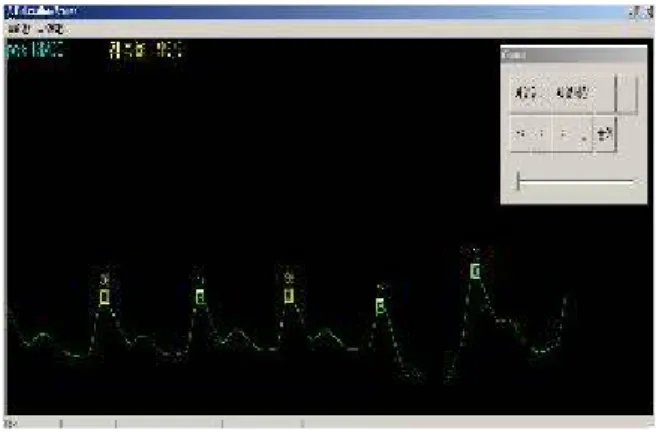 그림  9.맥박  검출  프로그램  화면 Fig.9  display  for  HRV  detection  program